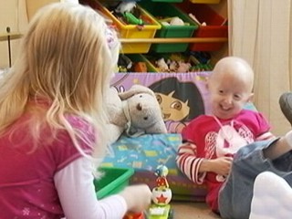 Progeria Syndrome News, Photos and Videos - ABC News