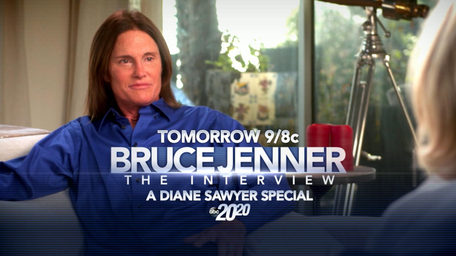  of hair loss 2020 bruce jenner the interview watch and balding by 2020