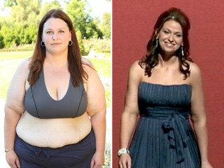 before and after extreme weight loss