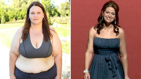 Extreme Makeover Weight Loss Jackie