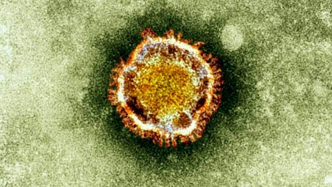 ap sars coronavirus ll 130213 wblog SARS Like Virus May Be Spreading Through Human Contact 