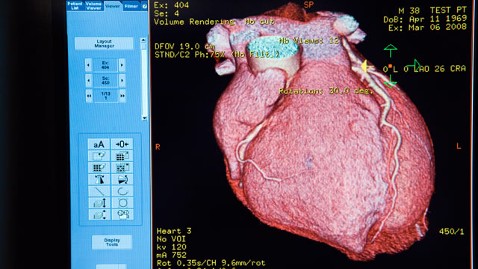 gty heart scan nt 120314 wblog Mans Failing Heart Heals Itself on Day of Emergency Transplant