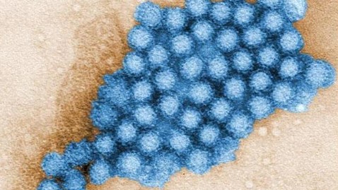 ht norovirus ll 130125 wblog Doctors Warn of New Stomach Superbug Hitting U.S.
