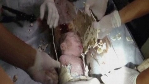 rt baby thrown down drain pipe Survives china thg 130528 wblog Newborn Baby Rescued From Toilet Pipe in China