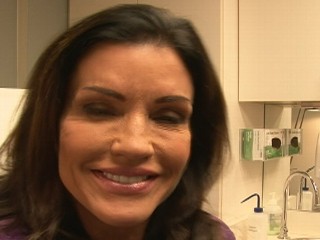  Perry Plastic Surgery on Janice Dickinson Fights Surgery Critics