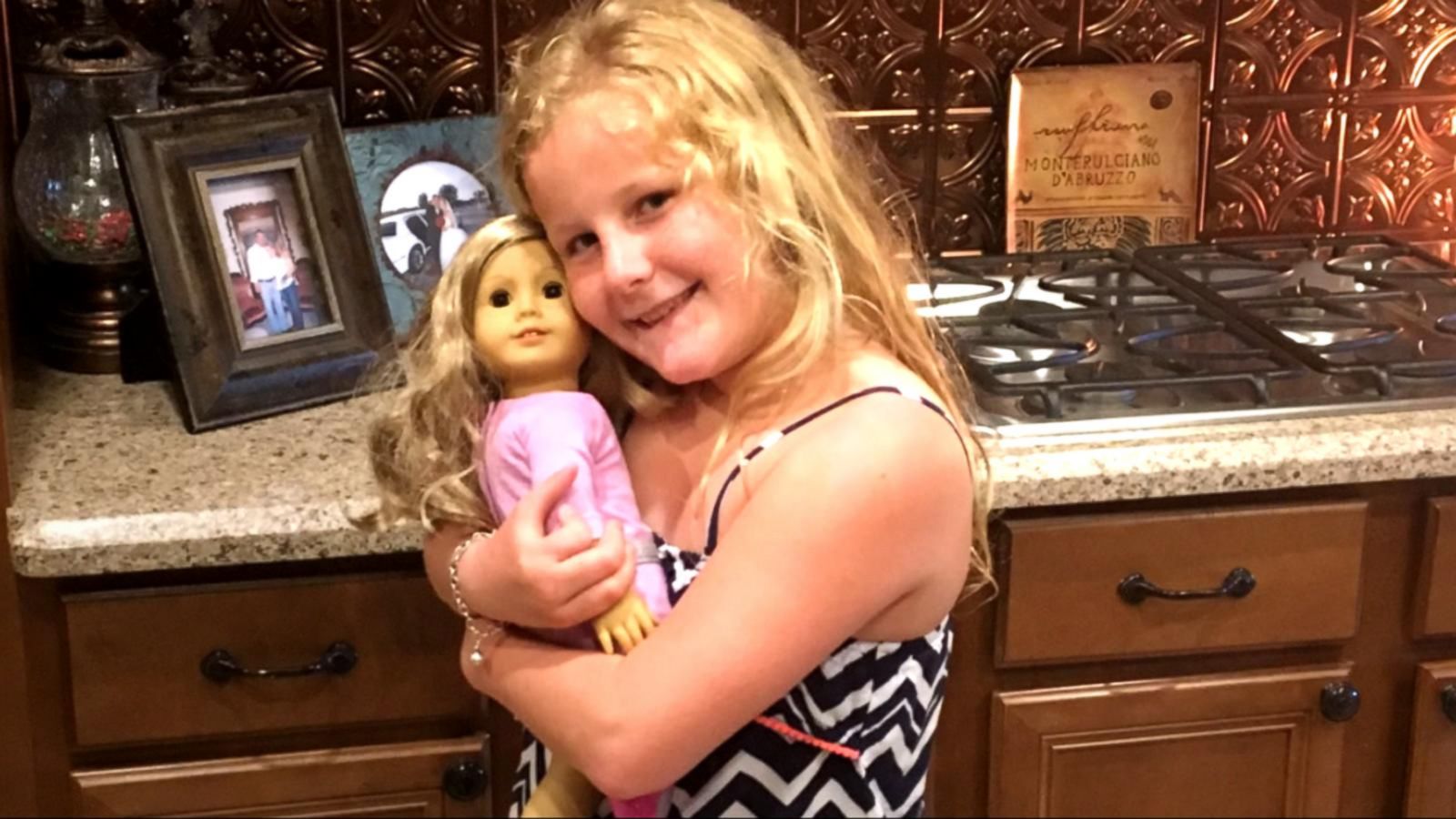 10-Year-Old Receives Doll with Matching Prosthetic Leg